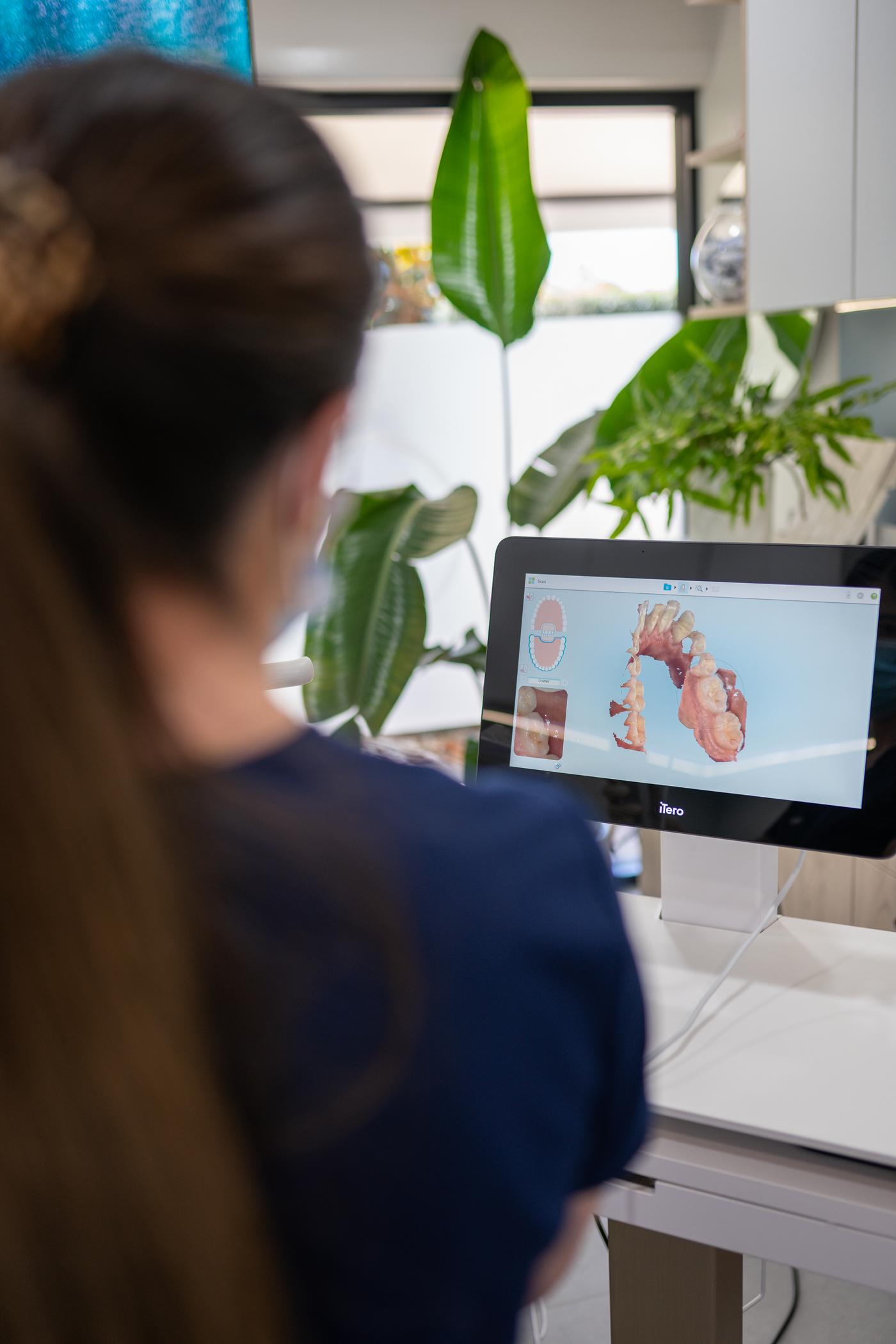 iTero digital scan for Invisalign at Helix Dental